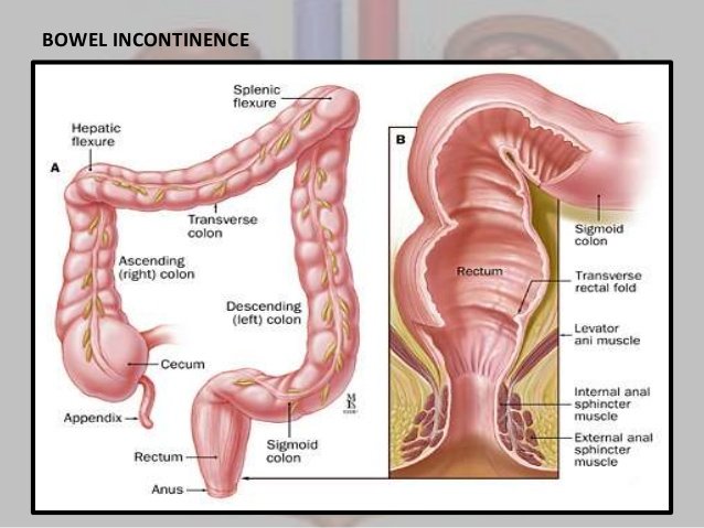 Best Fecal Incontinence Laser Treatment/ Surgery in gurgaon