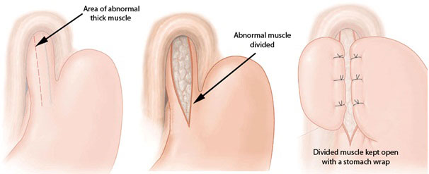 cardia treatment clinic gurgaon