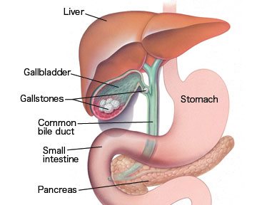 best gallbladder surgeon in gurgaon