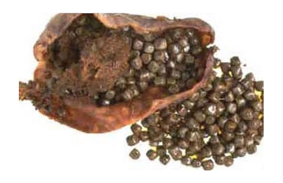 gallstones laparoscopic treatment gurgaon