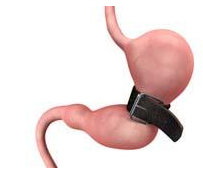 Best Bariatric Doctor In Gurgaon