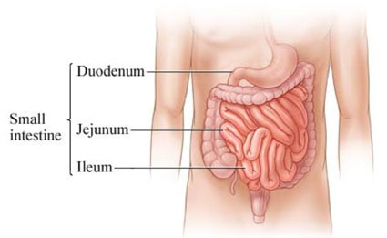 Crohn'S Disease Treatment in Gurgaon