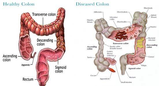 colon hydrotherapy services