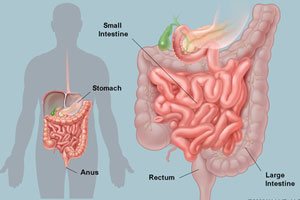 intestine surgery gurgaon