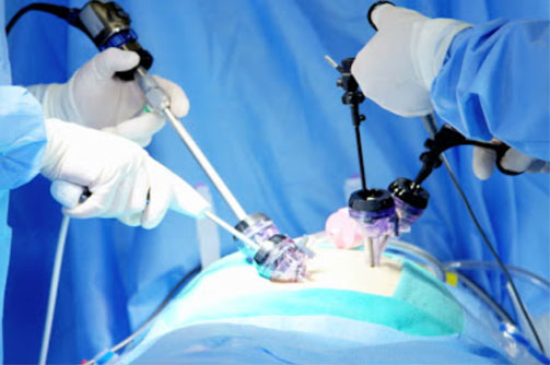 laparoscopy specialist gurgaon
